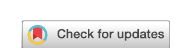 Check for updates バッジ